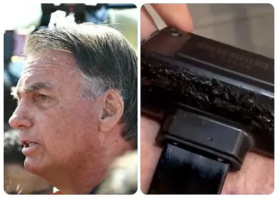 Bolsonaro confessa que queimou tornozeleira com ferro quente e justifica: “Curiosidade”