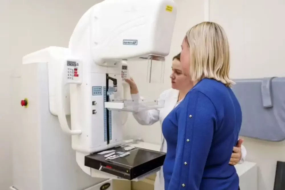 Senado aprova mamografia pelo SUS para mulheres a partir dos 40 anos