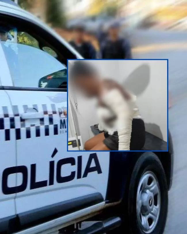 Mulher tem 40% do corpo queimado pelo marido durante briga em Campo Novo do Parecis
